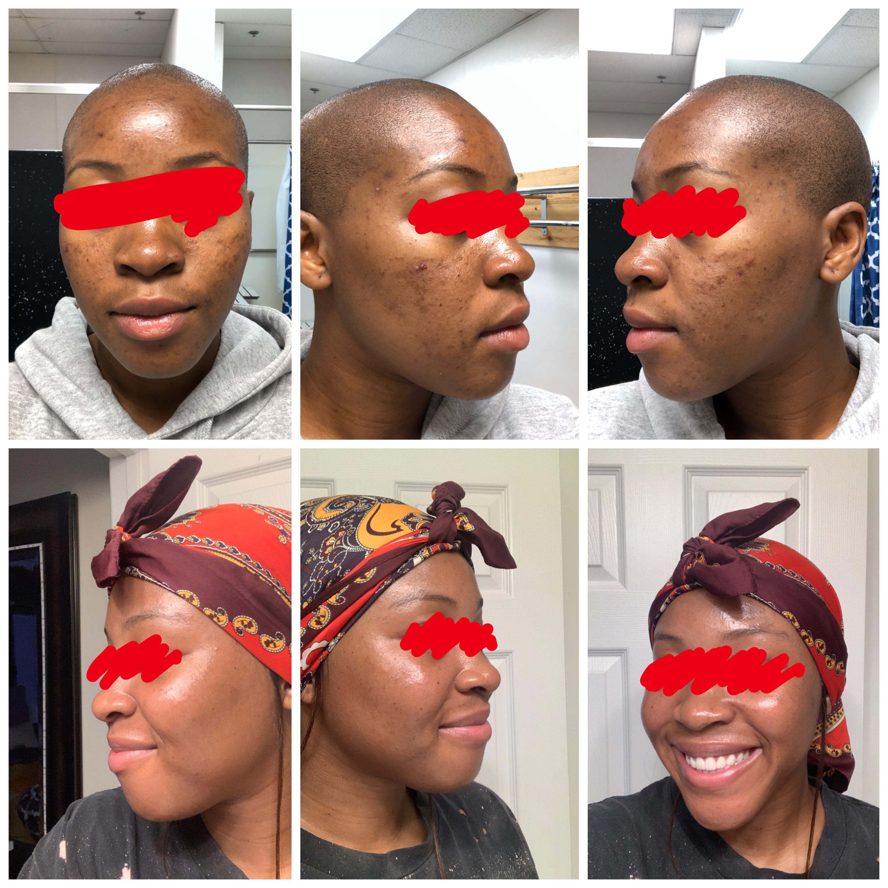 Dark spot correcting serum